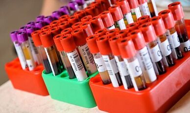 dietas para perda de peso de acordo com o tipo sanguíneo